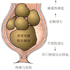 便秘要做什么检查?